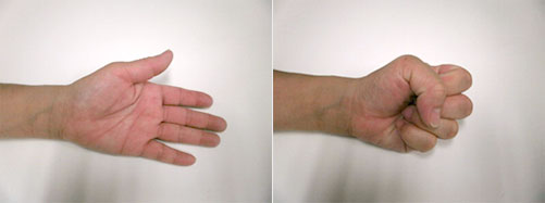 ばね指の治療 大宮の大宮はしもと整形外科