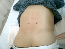 腰痛の治療 大宮の大宮はしもと整形外科